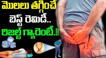 రాత్రికి రాత్రే ఫైల్స్, మొలలు తగ్గించే బెస్ట్ రెమిడీ…!