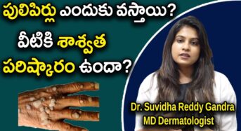  పులిపిర్లు ఎందుకు వస్తాయి..? వీటికి శాశ్వత పరిష్కారం ఉందా..!