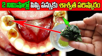 Teeth Tips : 2 నిమిషాలలో ఎంతటి గార పట్టిన పసుపు పళ్ళు అయిన తెల్లగా మెరిసిపోతాయి…!!