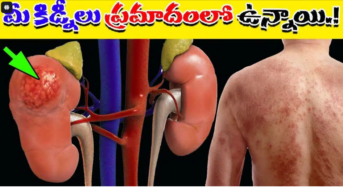 Kidney Failure Symptoms : శరీరంలో ఈ లక్షణాలు కనిపిస్తే కిడ్నీలు ప్రమాదంలో పడినట్లే..