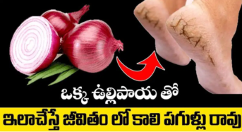 Cracked Heels : ఉల్లిపాయతో రాత్రికి రాత్రి కాళ్ల పగుళ్లు మాయం…!!