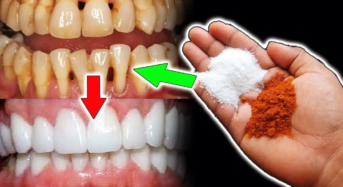 Whiten Teeth : రెండు నిమిషాలలో ఎంతటి గార పట్టిన పసుపు పళ్ళైన తెల్లగా మెరిసిపోతాయి..!!