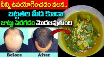 Hair Growth : దీన్ని ఉపయోగించడం వలన బట్టతల మీద కూడా జుట్టు పెరగడం మొదలవుతుంది…!