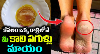 Beauty Tips : కాళ్ల పగుళ్లతో తెగ ఇబ్బంది పడిపోతున్నారా.. అయితే ఒక్కసారి ఇది రాయాల్సిందే!