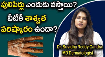 Pimples Occur : పులిపిర్లు ఎందుకు వస్తాయి..? వీటికి శాశ్వత పరిష్కారం ఉందా..!