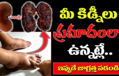 Kidney Failure : మీ కిడ్నీలు ప్రమాదంలో ఉన్నాయని తెలిపే లక్షణాలు ఇవే…!