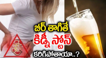 Beer : బీరు తాగితే కిడ్నీలో స్టోన్స్ కరిగిపోతాయా..?