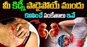 మీ కిడ్నీలు ప్రమాదంలో ఉన్నాయని తెలిపే లక్షణాలు ఇవే…!