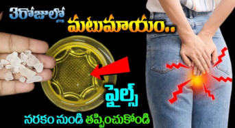 Piles : ఎంతటి భయంకరమైన ఫైల్స్ అయినా 3 రోజులలో మటుమాయం…!