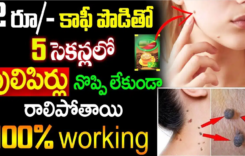 కాఫీ పొడితో 5 సెకండ్ లో పులిపిర్లు నొప్పి లేకుండా రాలిపోతాయి…