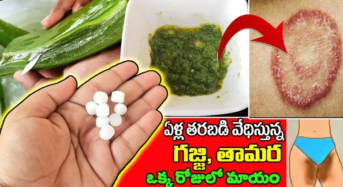భయంకరమైన గజ్జి ,తామర రాత్రికి రాత్రే మాయం…!